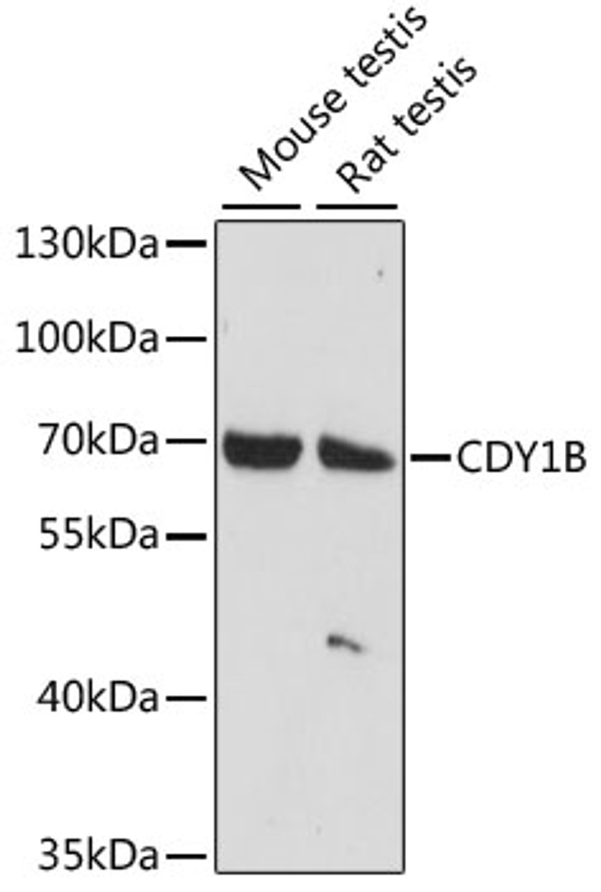 Western blot analysis of extracts of various cell lines, using CDY1B antibody (16-118) at 1:1000 dilution.<br/>Secondary antibody: HRP Goat Anti-Rabbit IgG (H+L) at 1:10000 dilution.<br/>Lysates/proteins: 25ug per lane.<br/>Blocking buffer: 3% nonfat dry milk in TBST.<br/>Detection: ECL Basic Kit.<br/>Exposure time: 30s.