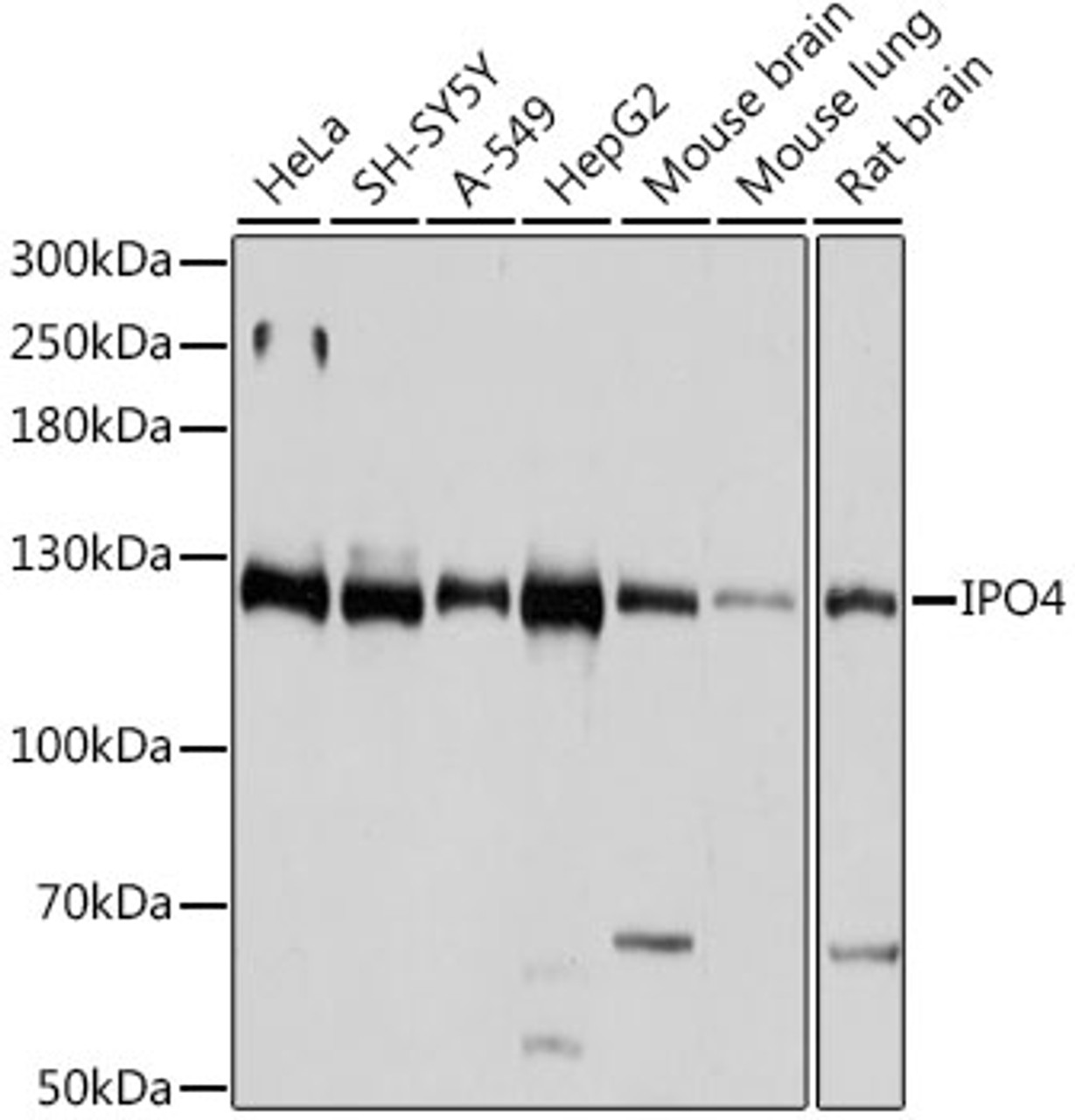 Western blot analysis of extracts of various cell lines, using IPO4 antibody (16-130) at 1:1000 dilution.<br/>Secondary antibody: HRP Goat Anti-Rabbit IgG (H+L) at 1:10000 dilution.<br/>Lysates/proteins: 25ug per lane.<br/>Blocking buffer: 3% nonfat dry milk in TBST.<br/>Detection: ECL Basic Kit.<br/>Exposure time: 1s.