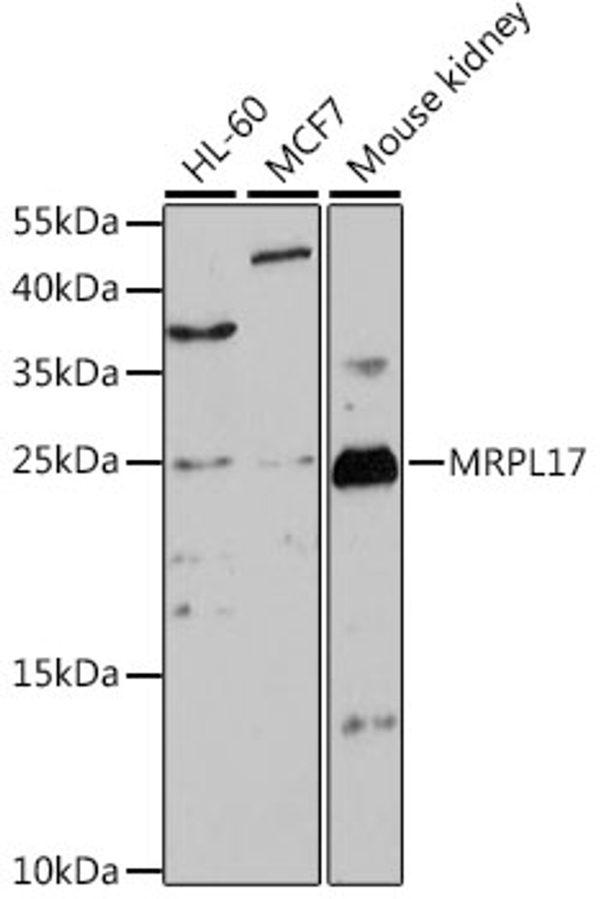 Western blot analysis of extracts of various cell lines, using MRPL17 antibody (16-131) at 1:1000 dilution.<br/>Secondary antibody: HRP Goat Anti-Rabbit IgG (H+L) at 1:10000 dilution.<br/>Lysates/proteins: 25ug per lane.<br/>Blocking buffer: 3% nonfat dry milk in TBST.<br/>Detection: ECL Basic Kit.<br/>Exposure time: 3min.