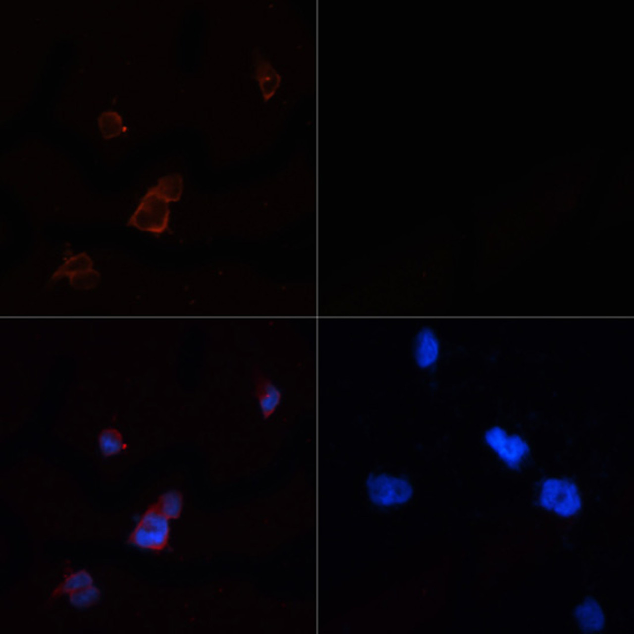 Immunofluorescence analysis of 293T cells using ACACA antibody (16-133) at dilution of 1:100. 293T cells were treated by Hydrogen Peroxide (2 nM) at 37℃ for 15 minutes after serum-starvation overnight (left) . Blue: DAPI for nuclear staining.