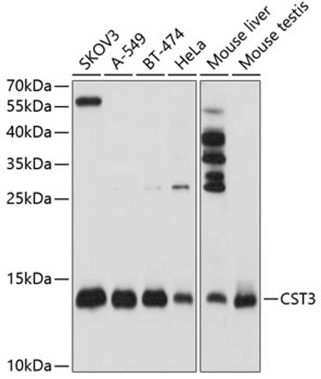 Western blot analysis of extracts of various cell lines, using CST3 antibody (16-135) at 1:1000 dilution.<br/>Secondary antibody: HRP Goat Anti-Rabbit IgG (H+L) at 1:10000 dilution.<br/>Lysates/proteins: 25ug per lane.<br/>Blocking buffer: 3% nonfat dry milk in TBST.<br/>Detection: ECL Basic Kit.<br/>Exposure time: 10s.