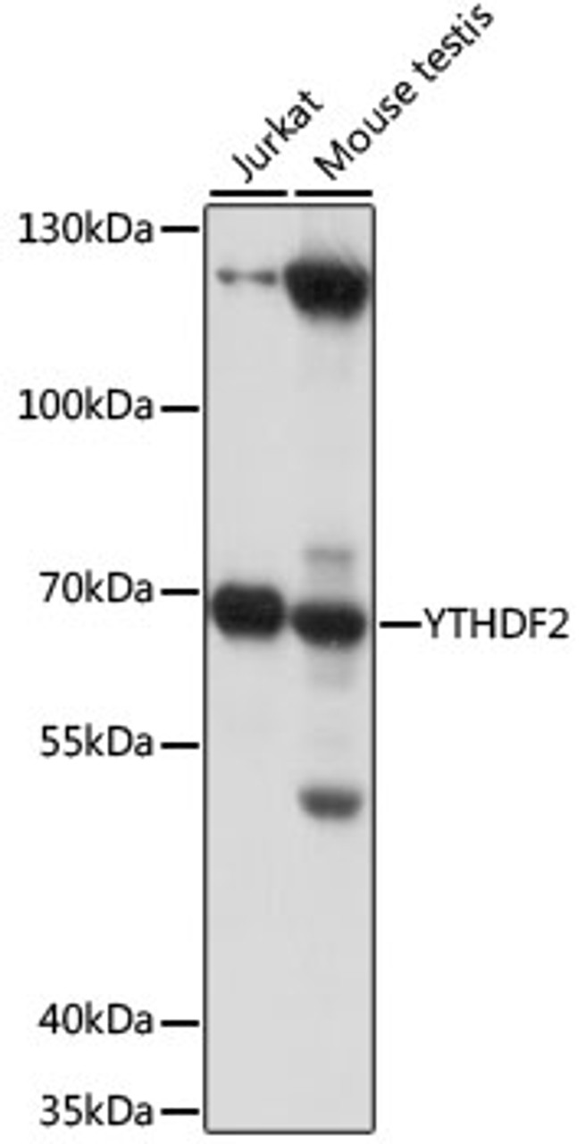 Western blot analysis of extracts of various cell lines, using YTHDF2 antibody (16-137) at 1:1000 dilution.<br/>Secondary antibody: HRP Goat Anti-Rabbit IgG (H+L) at 1:10000 dilution.<br/>Lysates/proteins: 25ug per lane.<br/>Blocking buffer: 3% nonfat dry milk in TBST.<br/>Detection: ECL Basic Kit.<br/>Exposure time: 3s.