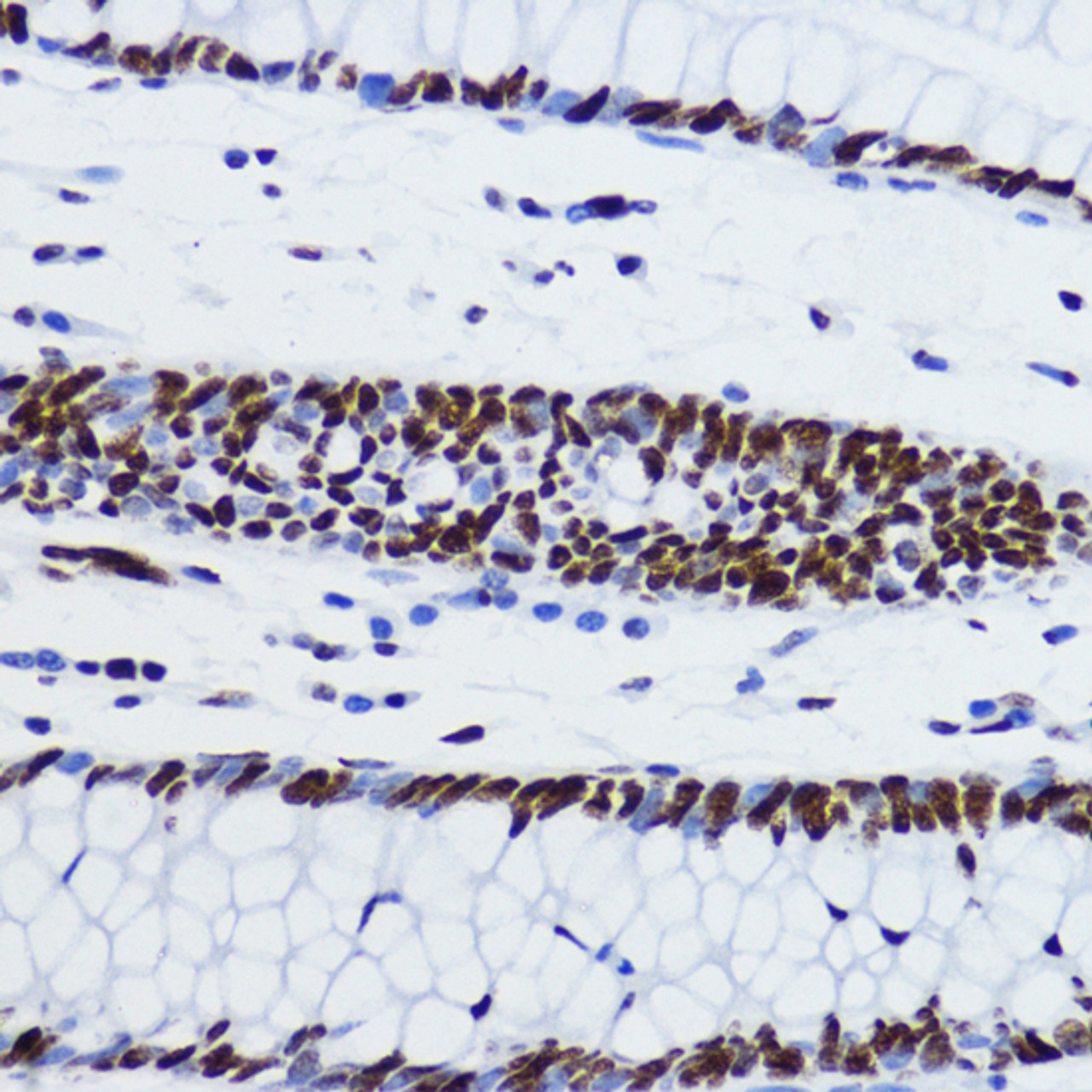 Immunohistochemistry of paraffin-embedded human colon using Acetyl-Histone H2B-K12 antibody (16-140) at dilution of 1:200 (40x lens) .
