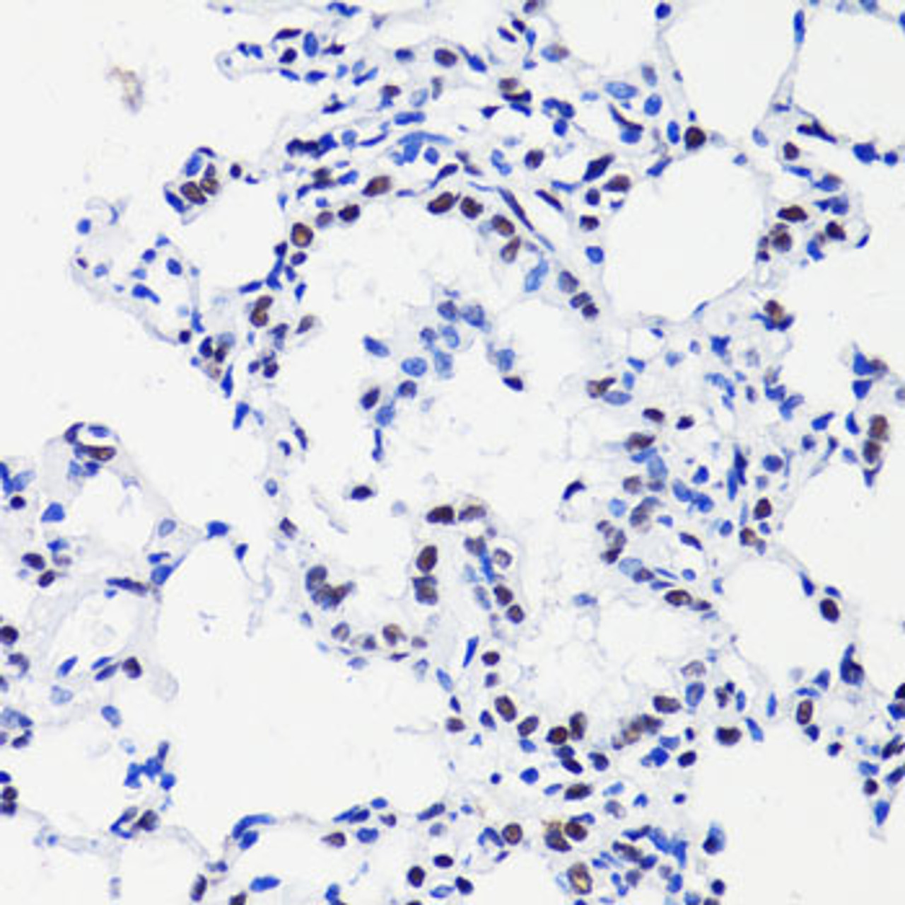 Immunohistochemistry of paraffin-embedded rat lung using H2B K15ac antibody (16-143) at dilution of 1:100 (40x lens) .