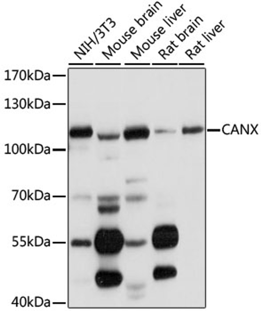 Western blot analysis of extracts of various cell lines, using CANX antibody (16-150) at 1:1000 dilution.<br/>Secondary antibody: HRP Goat Anti-Rabbit IgG (H+L) at 1:10000 dilution.<br/>Lysates/proteins: 25ug per lane.<br/>Blocking buffer: 3% nonfat dry milk in TBST.<br/>Detection: ECL Basic Kit.<br/>Exposure time: 5s.