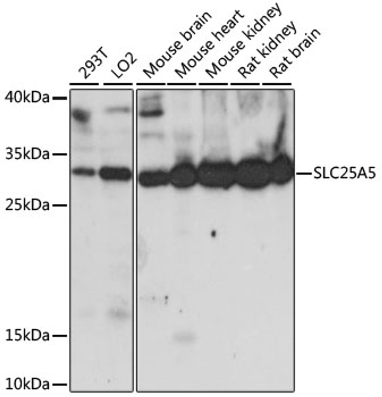 Western blot analysis of extracts of various cell lines, using SLC25A5 antibody (16-156) at 1:1000 dilution.<br/>Secondary antibody: HRP Goat Anti-Rabbit IgG (H+L) at 1:10000 dilution.<br/>Lysates/proteins: 25ug per lane.<br/>Blocking buffer: 3% nonfat dry milk in TBST.<br/>Detection: ECL Basic Kit.<br/>Exposure time: 60s.