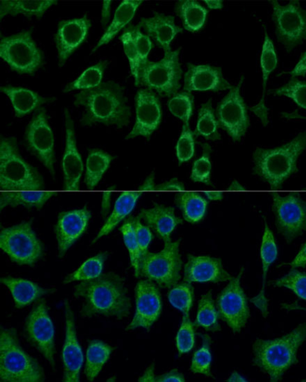 Immunofluorescence analysis of L929 cells using TSPO Polyclonal Antibody (16-159) at dilution of 1:100 (40x lens) . Blue: DAPI for nuclear staining.