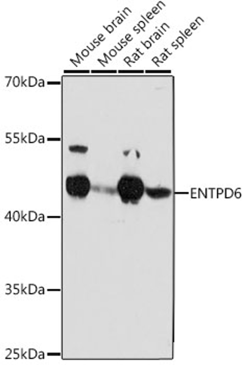 Western blot analysis of extracts of various cell lines, using ENTPD6 antibody (16-162) at 1:1000 dilution.<br/>Secondary antibody: HRP Goat Anti-Rabbit IgG (H+L) at 1:10000 dilution.<br/>Lysates/proteins: 25ug per lane.<br/>Blocking buffer: 3% nonfat dry milk in TBST.<br/>Detection: ECL Basic Kit.<br/>Exposure time: 90s.