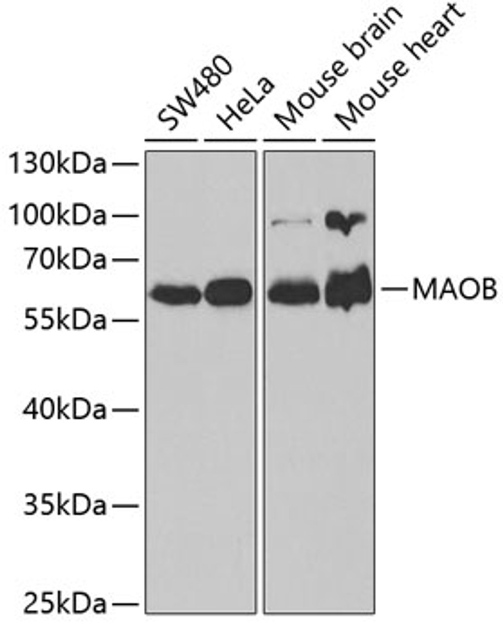 Western blot analysis of extracts of various cell lines, using MAOB antibody (16-178) at 1:1000 dilution.<br/>Secondary antibody: HRP Goat Anti-Rabbit IgG (H+L) at 1:10000 dilution.<br/>Lysates/proteins: 25ug per lane.<br/>Blocking buffer: 3% nonfat dry milk in TBST.