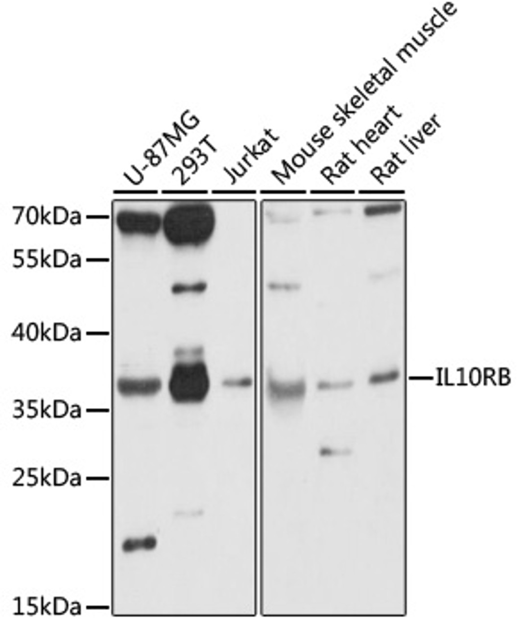 Western blot analysis of extracts of various cell lines, using IL10RB antibody (16-179) at 1:1000 dilution.<br/>Secondary antibody: HRP Goat Anti-Rabbit IgG (H+L) at 1:10000 dilution.<br/>Lysates/proteins: 25ug per lane.<br/>Blocking buffer: 3% nonfat dry milk in TBST.<br/>Detection: ECL Basic Kit.<br/>Exposure time: 30s.