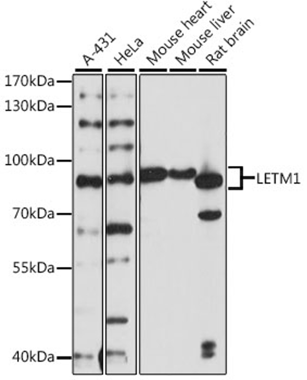Western blot analysis of extracts of various cell lines, using LETM1 antibody (16-182) at 1:1000 dilution.<br/>Secondary antibody: HRP Goat Anti-Rabbit IgG (H+L) at 1:10000 dilution.<br/>Lysates/proteins: 25ug per lane.<br/>Blocking buffer: 3% nonfat dry milk in TBST.<br/>Detection: ECL Basic Kit.<br/>Exposure time: 30s.