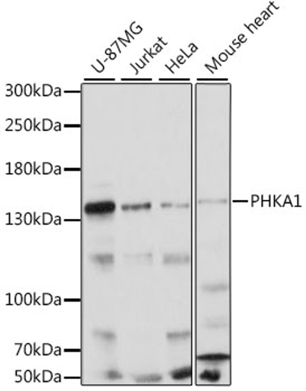 Western blot analysis of extracts of various cell lines, using PHKA1 antibody (16-188) at 1:1000 dilution.<br/>Secondary antibody: HRP Goat Anti-Rabbit IgG (H+L) at 1:10000 dilution.<br/>Lysates/proteins: 25ug per lane.<br/>Blocking buffer: 3% nonfat dry milk in TBST.<br/>Detection: ECL Basic Kit.<br/>Exposure time: 10s.