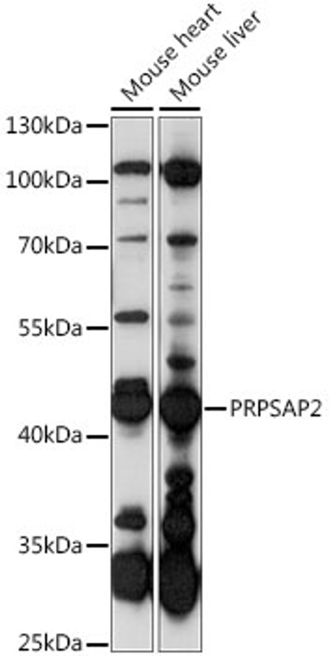 Western blot analysis of extracts of various cell lines, using PRPSAP2 antibody (16-194) at 1:1000 dilution.<br/>Secondary antibody: HRP Goat Anti-Rabbit IgG (H+L) at 1:10000 dilution.<br/>Lysates/proteins: 25ug per lane.<br/>Blocking buffer: 3% nonfat dry milk in TBST.<br/>Detection: ECL Basic Kit.<br/>Exposure time: 15s.