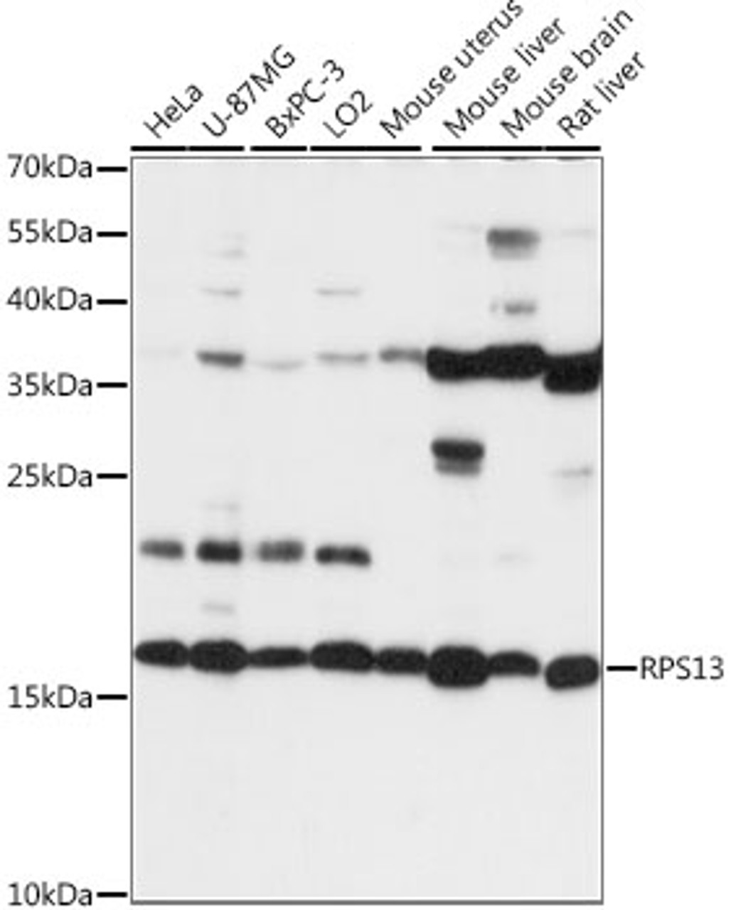 Western blot analysis of extracts of various cell lines, using RPS13 antibody (16-197) at 1:1000 dilution.<br/>Secondary antibody: HRP Goat Anti-Rabbit IgG (H+L) at 1:10000 dilution.<br/>Lysates/proteins: 25ug per lane.<br/>Blocking buffer: 3% nonfat dry milk in TBST.<br/>Detection: ECL Basic Kit.<br/>Exposure time: 20s.