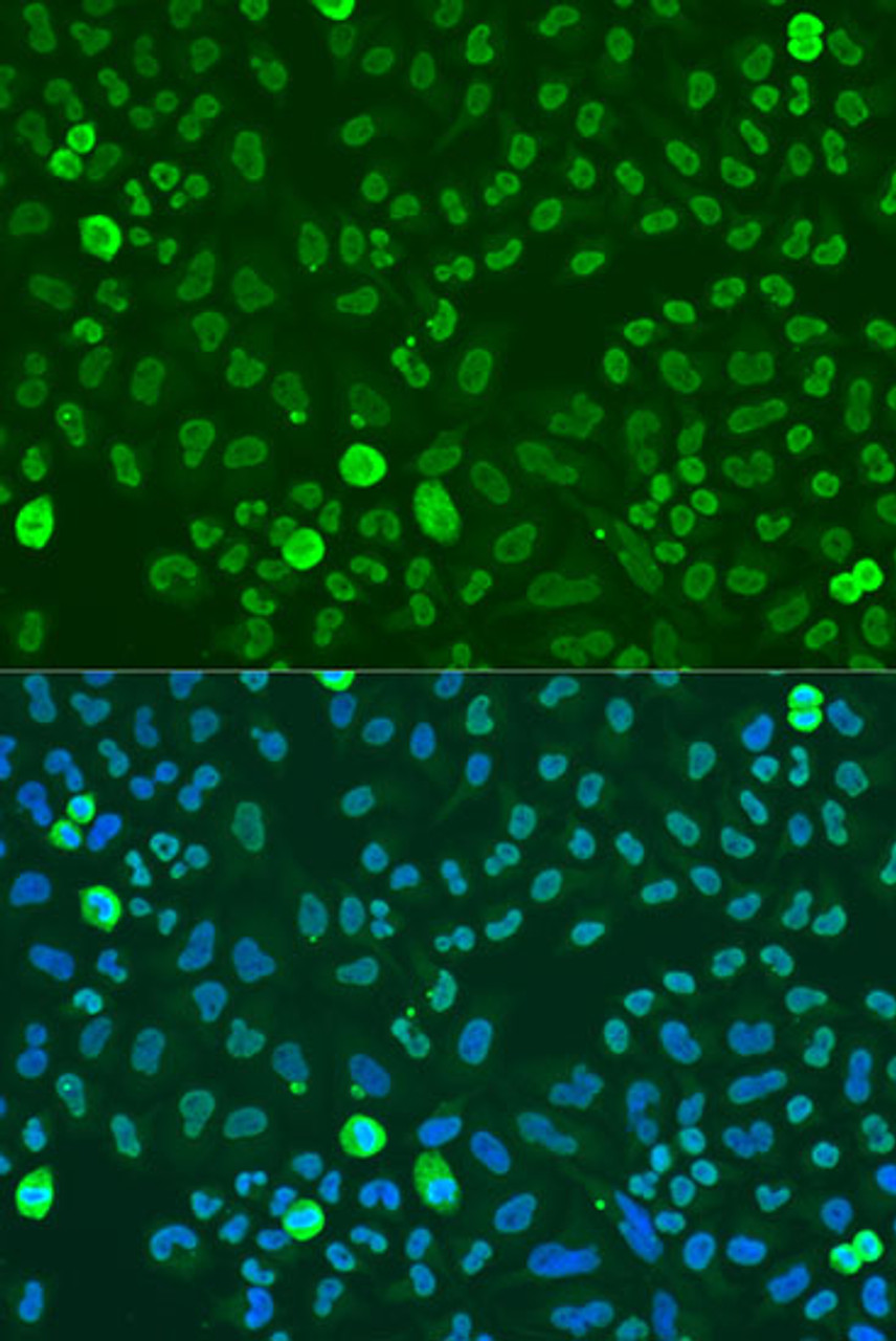 Immunofluorescence analysis of U2OS cells using SAFB antibody (16-198) at dilution of 1:100. Blue: DAPI for nuclear staining.