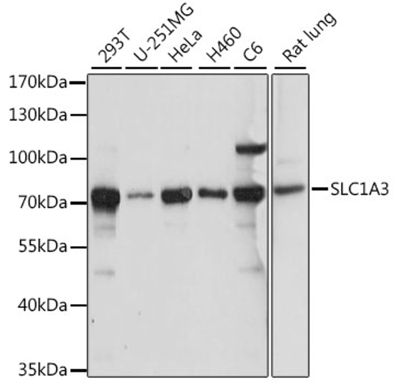 Western blot analysis of extracts of various cell lines, using SLC1A3 antibody (16-199) at 1:1000 dilution.<br/>Secondary antibody: HRP Goat Anti-Rabbit IgG (H+L) at 1:10000 dilution.<br/>Lysates/proteins: 25ug per lane.<br/>Blocking buffer: 3% nonfat dry milk in TBST.<br/>Detection: ECL Basic Kit.<br/>Exposure time: 10s.