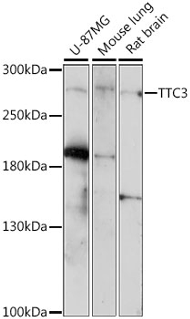Western blot analysis of extracts of various cell lines, using TTC3 antibody (16-207) at 1:1000 dilution.<br/>Secondary antibody: HRP Goat Anti-Rabbit IgG (H+L) at 1:10000 dilution.<br/>Lysates/proteins: 25ug per lane.<br/>Blocking buffer: 3% nonfat dry milk in TBST.<br/>Detection: ECL Enhanced Kit.<br/>Exposure time: 3min.