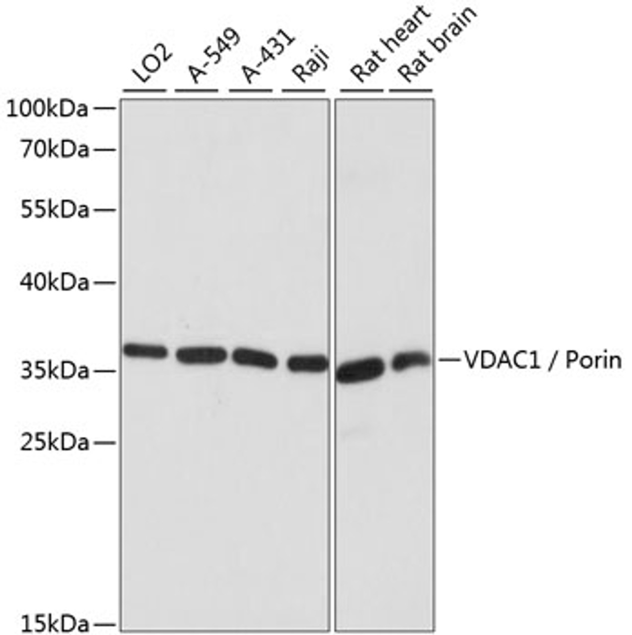 Western blot analysis of extracts of various cell lines, using VDAC1 / Porin antibody (16-208) at 1:1000 dilution.<br/>Secondary antibody: HRP Goat Anti-Rabbit IgG (H+L) at 1:10000 dilution.<br/>Lysates/proteins: 25ug per lane.<br/>Blocking buffer: 3% nonfat dry milk in TBST.<br/>Detection: ECL Basic Kit.<br/>Exposure time: 10s.