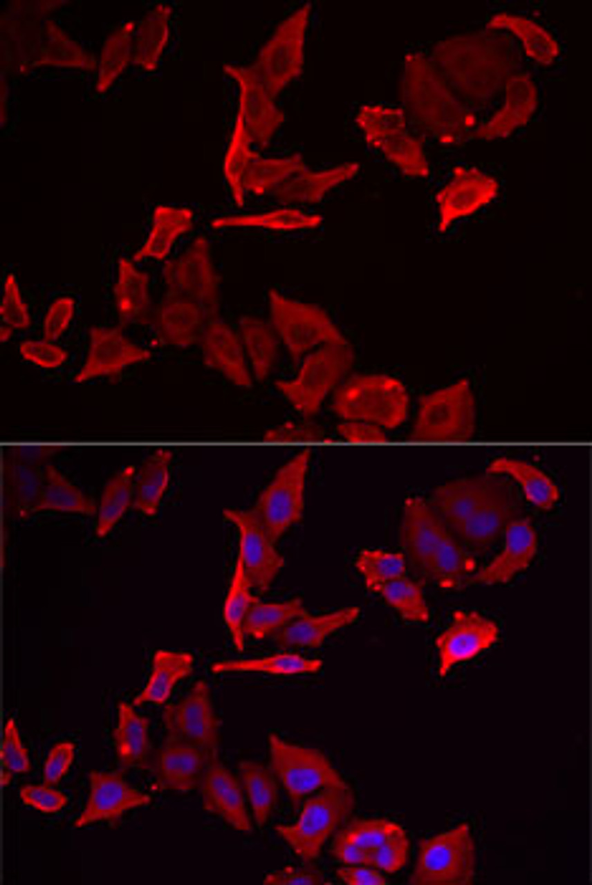 Immunofluorescence analysis of MCF7 cells using SKAP2 antibody (16-213) . Blue: DAPI for nuclear staining.