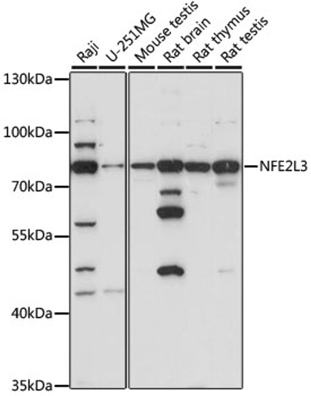 Western blot analysis of extracts of various cell lines, using NFE2L3 antibody (16-217) at 1:1000 dilution.<br/>Secondary antibody: HRP Goat Anti-Rabbit IgG (H+L) at 1:10000 dilution.<br/>Lysates/proteins: 25ug per lane.<br/>Blocking buffer: 3% nonfat dry milk in TBST.<br/>Detection: ECL Basic Kit.<br/>Exposure time: 10s.