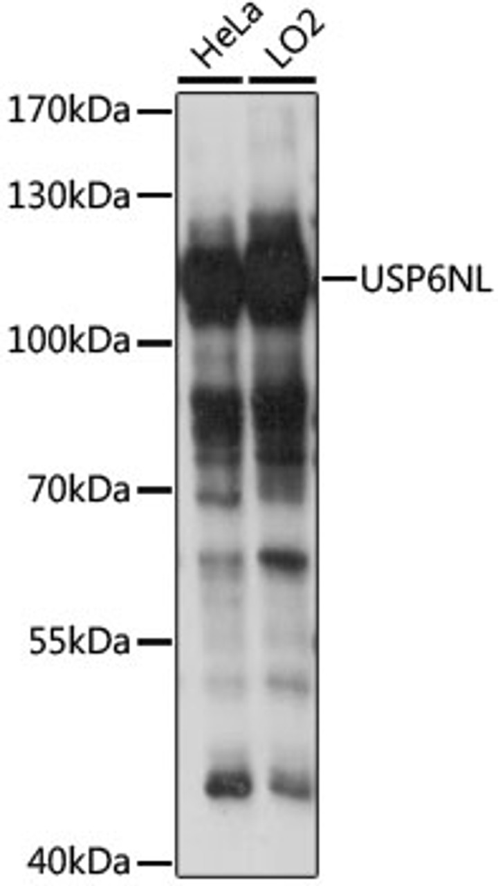 Western blot analysis of extracts of various cell lines, using USP6NL antibody (16-219) at 1:1000 dilution.<br/>Secondary antibody: HRP Goat Anti-Rabbit IgG (H+L) at 1:10000 dilution.<br/>Lysates/proteins: 25ug per lane.<br/>Blocking buffer: 3% nonfat dry milk in TBST.<br/>Detection: ECL Basic Kit.<br/>Exposure time: 10s.