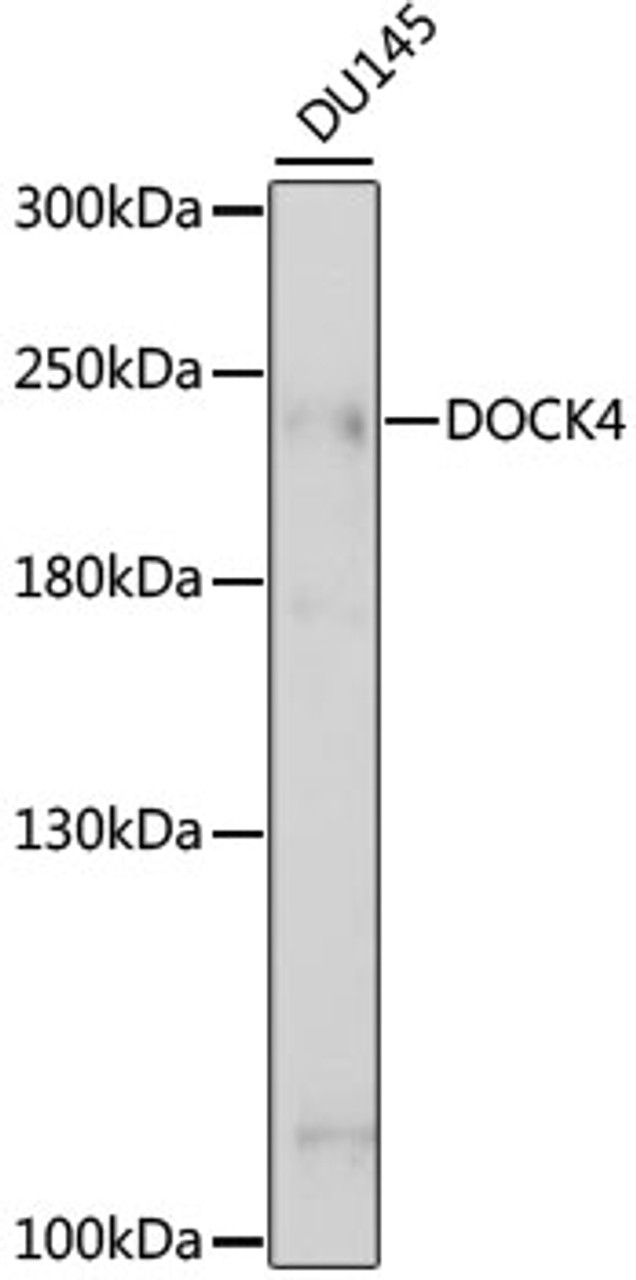 Western blot analysis of extracts of DU145 cells, using DOCK4 antibody (16-220) at 1:1000 dilution.<br/>Secondary antibody: HRP Goat Anti-Rabbit IgG (H+L) at 1:10000 dilution.<br/>Lysates/proteins: 25ug per lane.<br/>Blocking buffer: 3% nonfat dry milk in TBST.<br/>Detection: ECL Basic Kit.<br/>Exposure time: 30s.