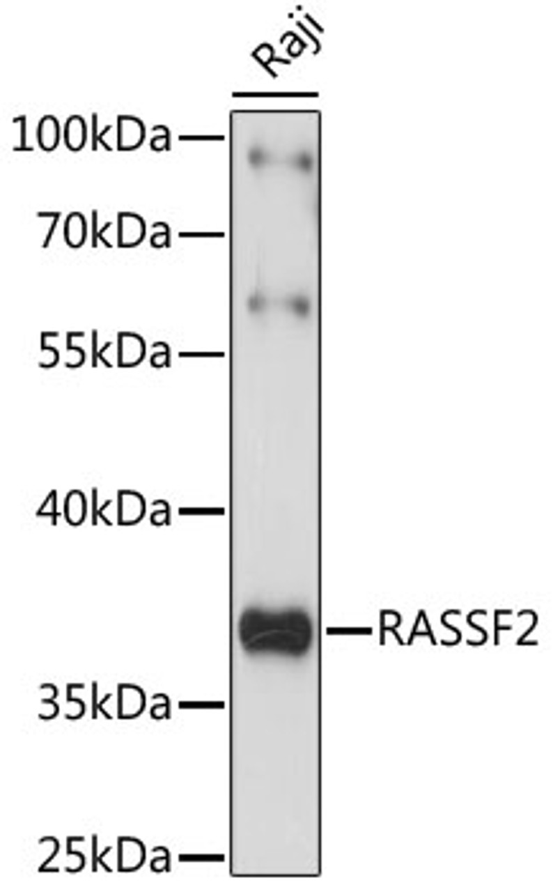 Western blot analysis of extracts of Raji cells, using RASSF2 antibody (16-222) at 1:1000 dilution.<br/>Secondary antibody: HRP Goat Anti-Rabbit IgG (H+L) at 1:10000 dilution.<br/>Lysates/proteins: 25ug per lane.<br/>Blocking buffer: 3% nonfat dry milk in TBST.<br/>Detection: ECL Enhanced Kit.<br/>Exposure time: 1s.