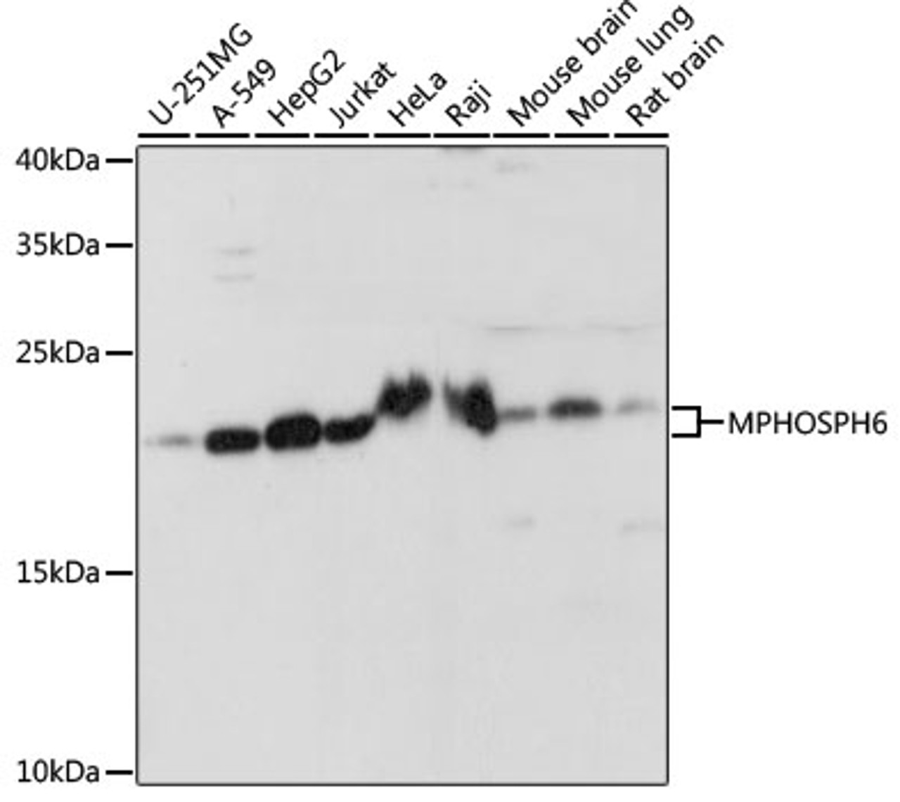 Western blot analysis of extracts of various cell lines, using MPHOSPH6 antibody (16-225) at 1:1000 dilution.<br/>Secondary antibody: HRP Goat Anti-Rabbit IgG (H+L) at 1:10000 dilution.<br/>Lysates/proteins: 25ug per lane.<br/>Blocking buffer: 3% nonfat dry milk in TBST.<br/>Detection: ECL Basic Kit.<br/>Exposure time: 10s.