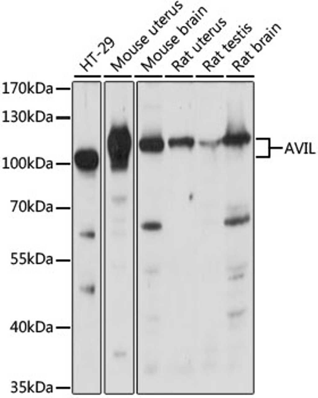 Western blot analysis of extracts of various cell lines, using AVIL antibody (16-231) at 1:1000 dilution.<br/>Secondary antibody: HRP Goat Anti-Rabbit IgG (H+L) at 1:10000 dilution.<br/>Lysates/proteins: 25ug per lane.<br/>Blocking buffer: 3% nonfat dry milk in TBST.<br/>Detection: ECL Basic Kit.<br/>Exposure time: 30s.