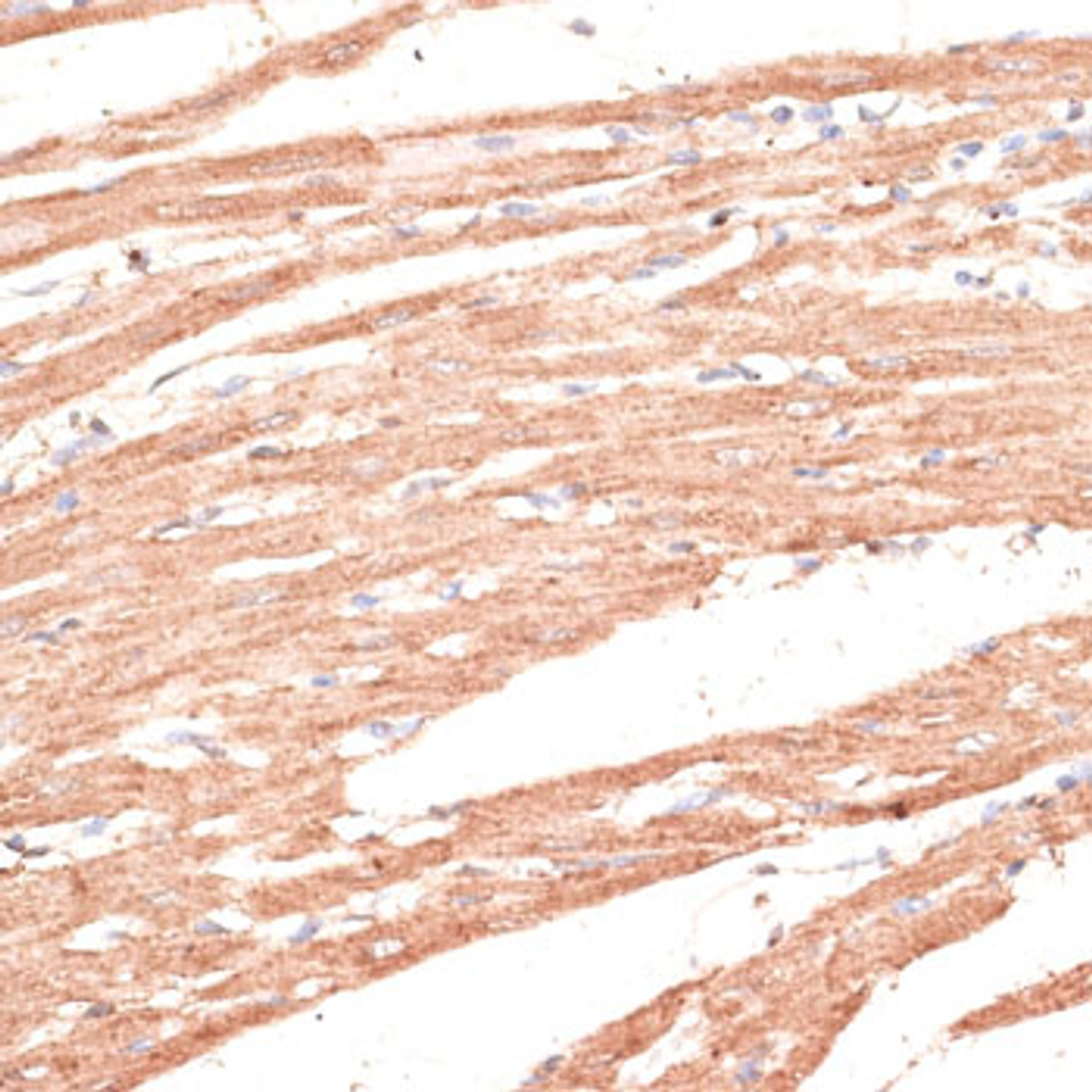 Immunohistochemistry of paraffin-embedded rat heart using KIF1C antibody (16-232) at dilution of 1:100 (40x lens) .