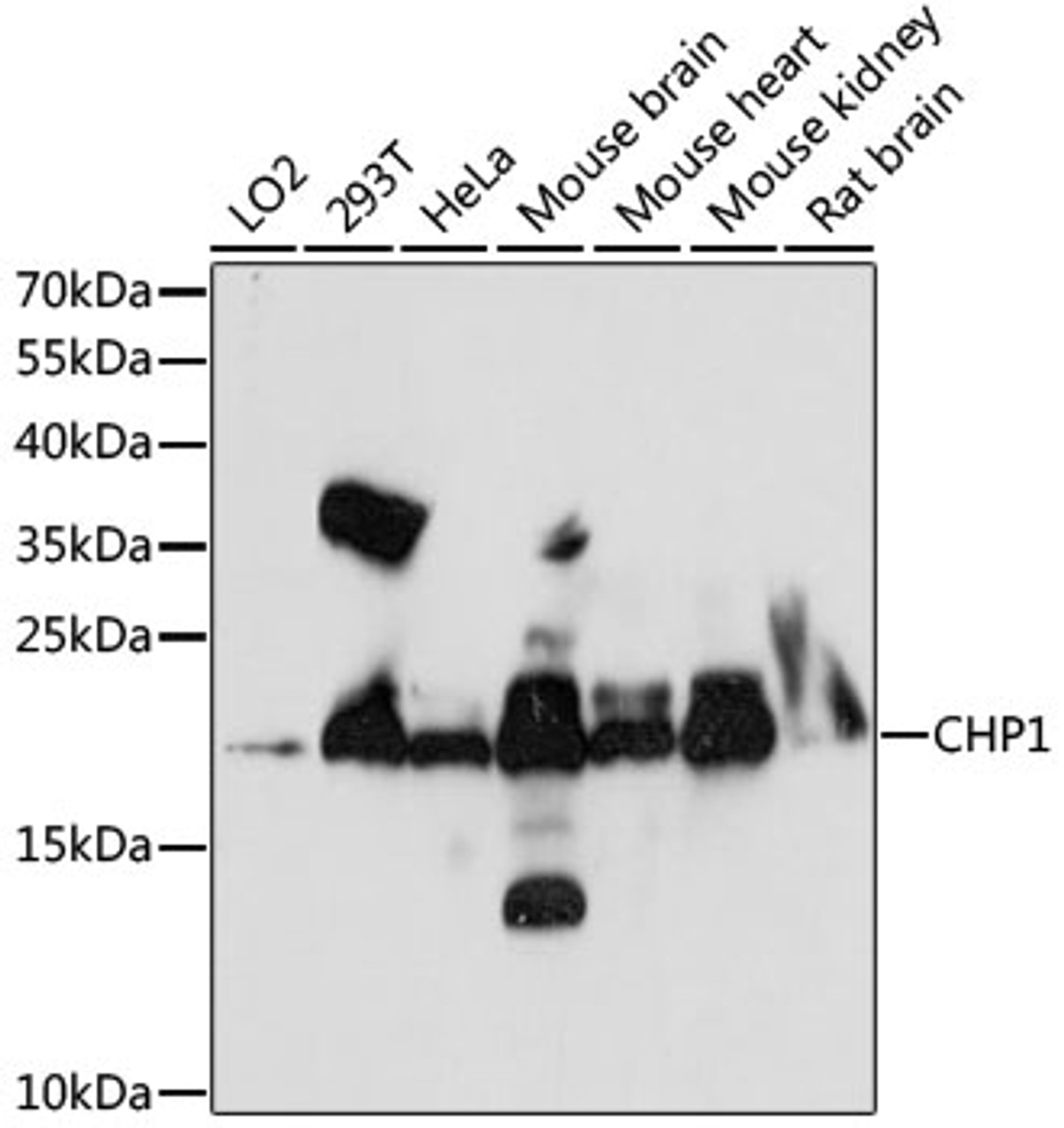 Western blot analysis of extracts of various cell lines, using CHP1 antibody (16-234) at 1:1000 dilution.<br/>Secondary antibody: HRP Goat Anti-Rabbit IgG (H+L) at 1:10000 dilution.<br/>Lysates/proteins: 25ug per lane.<br/>Blocking buffer: 3% nonfat dry milk in TBST.<br/>Detection: ECL Enhanced Kit.<br/>Exposure time: 90s.