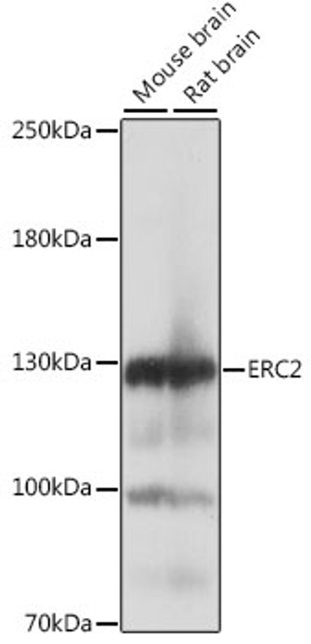 Western blot analysis of extracts of various cell lines, using ERC2 antibody (16-247) at 1:1000 dilution.<br/>Secondary antibody: HRP Goat Anti-Rabbit IgG (H+L) at 1:10000 dilution.<br/>Lysates/proteins: 25ug per lane.<br/>Blocking buffer: 3% nonfat dry milk in TBST.<br/>Detection: ECL Basic Kit.<br/>Exposure time: 1s.