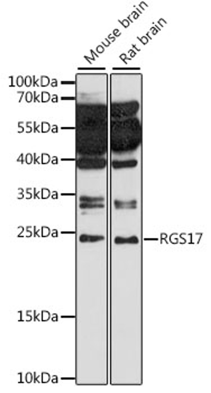 Western blot analysis of extracts of various cell lines, using RGS17 antibody (16-250) at 1:1000 dilution.<br/>Secondary antibody: HRP Goat Anti-Rabbit IgG (H+L) at 1:10000 dilution.<br/>Lysates/proteins: 25ug per lane.<br/>Blocking buffer: 3% nonfat dry milk in TBST.<br/>Detection: ECL Basic Kit.<br/>Exposure time: 90s.