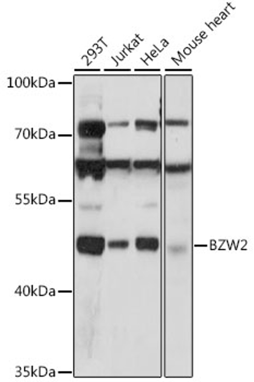 Western blot analysis of extracts of various cell lines, using BZW2 antibody (16-258) at 1:1000 dilution.<br/>Secondary antibody: HRP Goat Anti-Rabbit IgG (H+L) at 1:10000 dilution.<br/>Lysates/proteins: 25ug per lane.<br/>Blocking buffer: 3% nonfat dry milk in TBST.<br/>Detection: ECL Basic Kit.<br/>Exposure time: 90s.