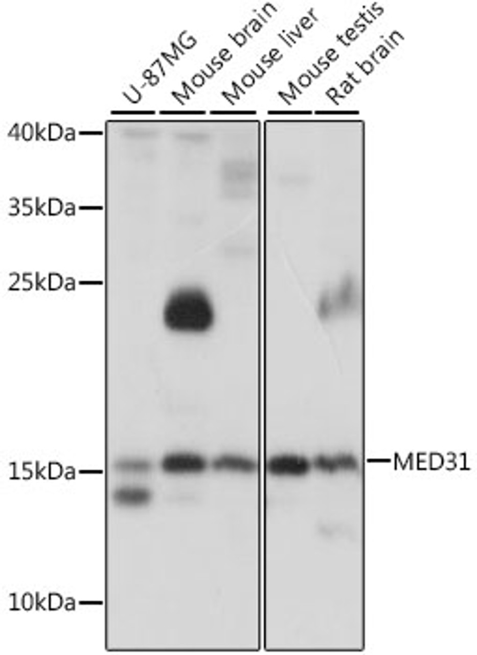 Western blot analysis of extracts of various cell lines, using MED31 antibody (16-264) at 1:1000 dilution.<br/>Secondary antibody: HRP Goat Anti-Rabbit IgG (H+L) at 1:10000 dilution.<br/>Lysates/proteins: 25ug per lane.<br/>Blocking buffer: 3% nonfat dry milk in TBST.<br/>Detection: ECL Basic Kit.<br/>Exposure time: 5s.