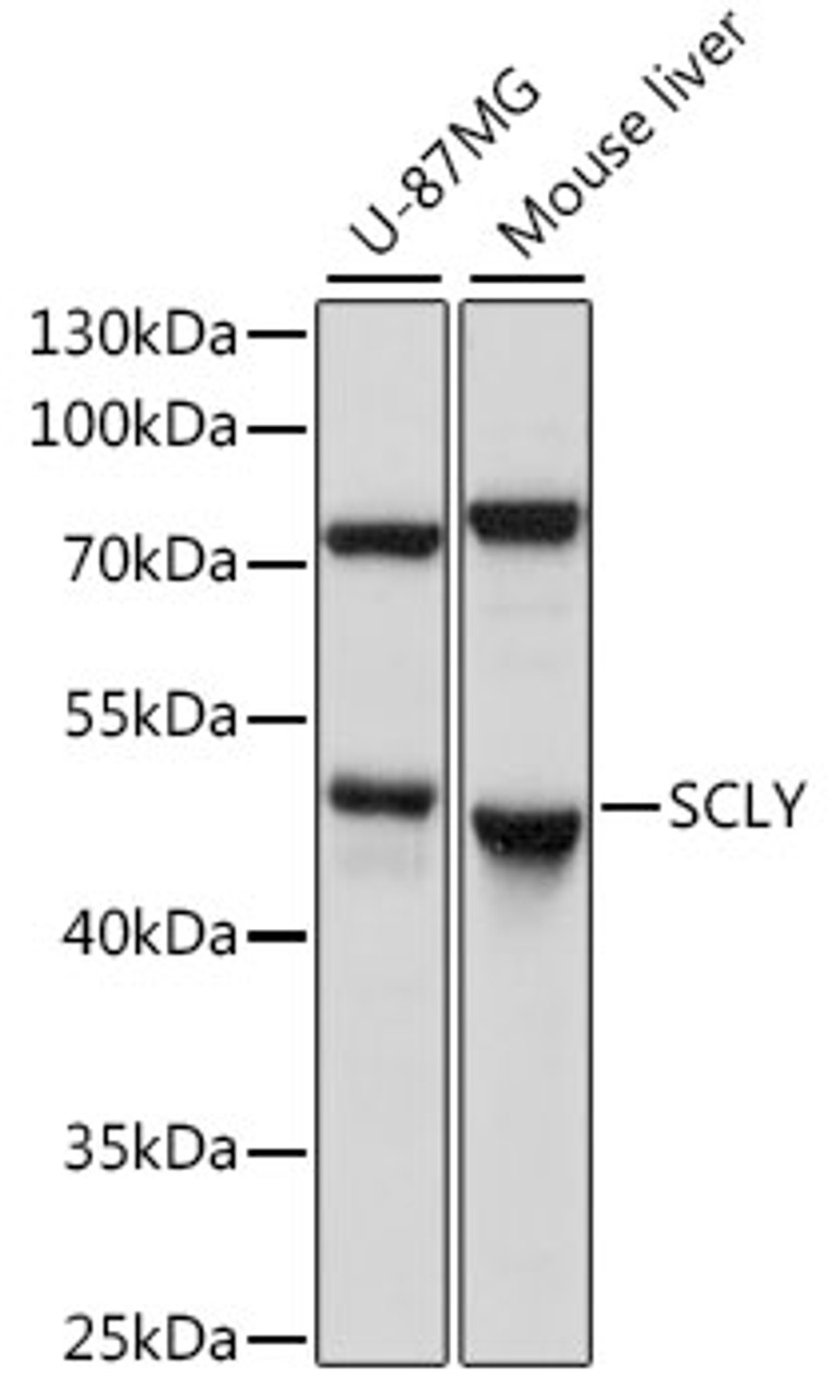 Western blot analysis of extracts of various cell lines, using SCLY antibody (16-270) at 1:1000 dilution.<br/>Secondary antibody: HRP Goat Anti-Rabbit IgG (H+L) at 1:10000 dilution.<br/>Lysates/proteins: 25ug per lane.<br/>Blocking buffer: 3% nonfat dry milk in TBST.<br/>Detection: ECL Basic Kit.<br/>Exposure time: 30s.