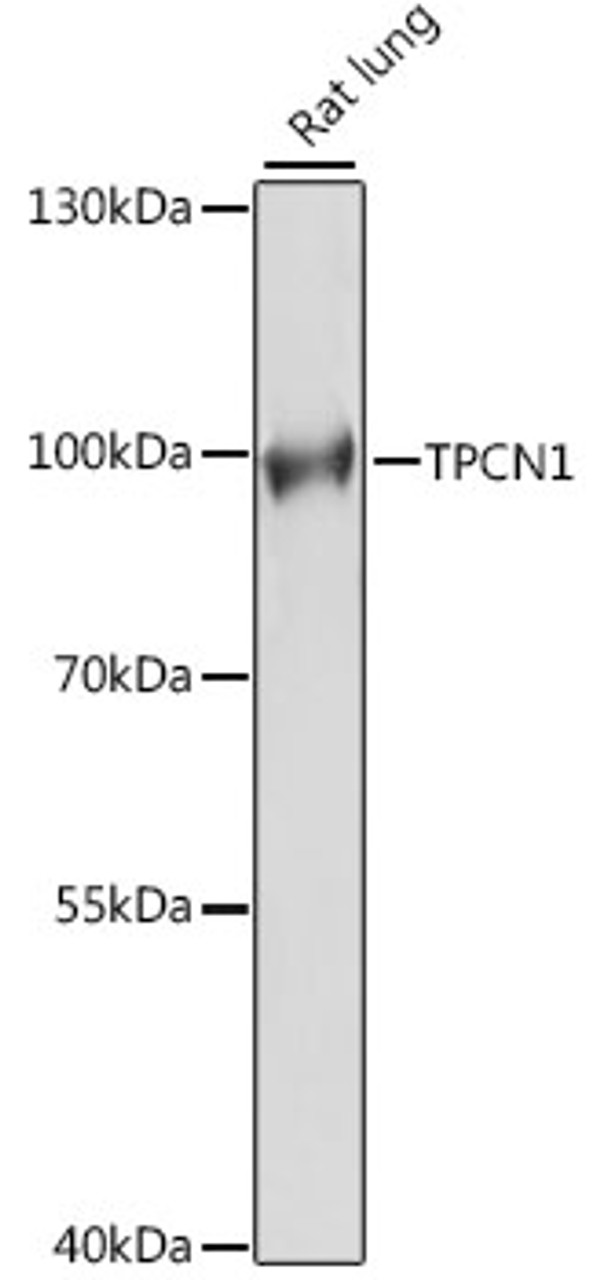 Western blot analysis of extracts of rat lung, using TPCN1 antibody (16-273) at 1:1000 dilution.<br/>Secondary antibody: HRP Goat Anti-Rabbit IgG (H+L) at 1:10000 dilution.<br/>Lysates/proteins: 25ug per lane.<br/>Blocking buffer: 3% nonfat dry milk in TBST.<br/>Detection: ECL Basic Kit.<br/>Exposure time: 5s.