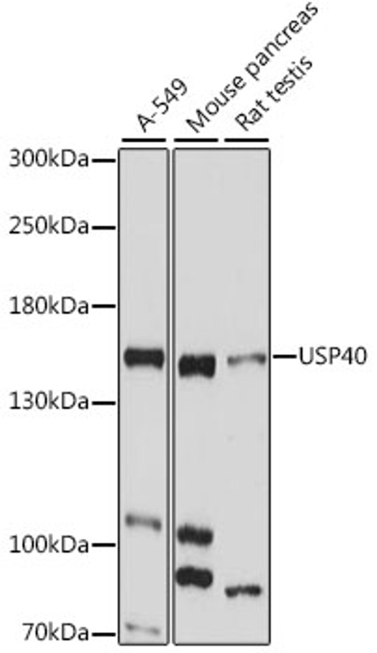 Western blot analysis of extracts of various cell lines, using USP40 antibody (16-280) at 1:1000 dilution.<br/>Secondary antibody: HRP Goat Anti-Rabbit IgG (H+L) at 1:10000 dilution.<br/>Lysates/proteins: 25ug per lane.<br/>Blocking buffer: 3% nonfat dry milk in TBST.<br/>Detection: ECL Basic Kit.<br/>Exposure time: 30s.