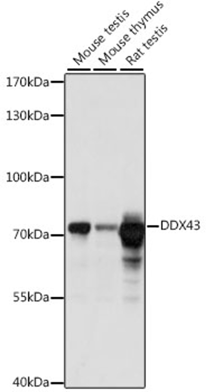 Western blot analysis of extracts of various cell lines, using DDX43 antibody (16-281) at 1:1000 dilution.<br/>Secondary antibody: HRP Goat Anti-Rabbit IgG (H+L) at 1:10000 dilution.<br/>Lysates/proteins: 25ug per lane.<br/>Blocking buffer: 3% nonfat dry milk in TBST.<br/>Detection: ECL Basic Kit.<br/>Exposure time: 10s.