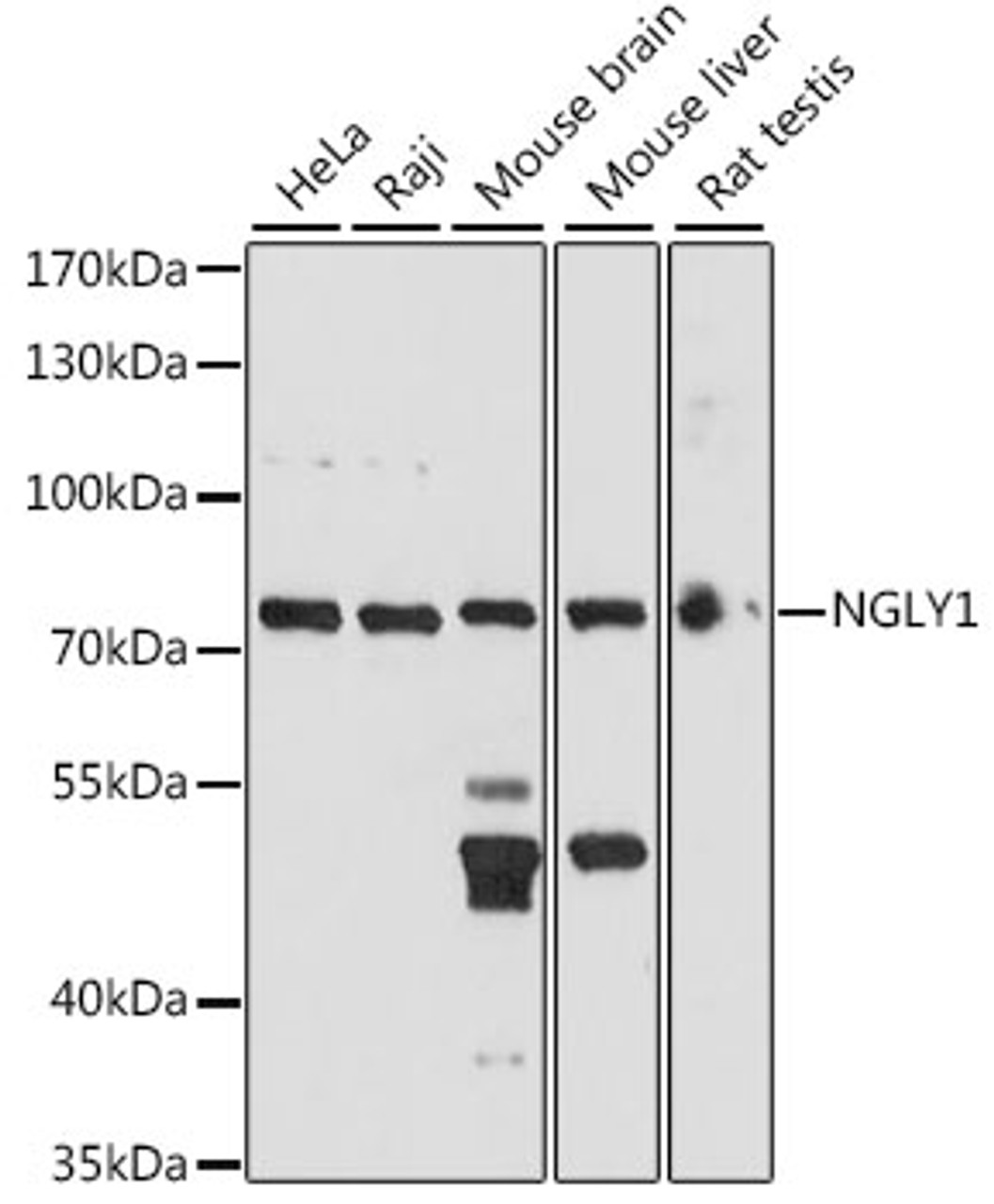 Western blot analysis of extracts of various cell lines, using NGLY1 antibody (16-285) at 1:1000 dilution.<br/>Secondary antibody: HRP Goat Anti-Rabbit IgG (H+L) at 1:10000 dilution.<br/>Lysates/proteins: 25ug per lane.<br/>Blocking buffer: 3% nonfat dry milk in TBST.<br/>Detection: ECL Basic Kit.<br/>Exposure time: 90s.