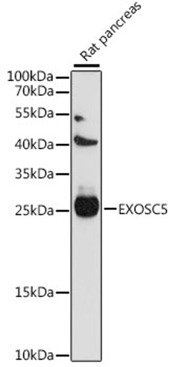 Western blot analysis of extracts of rat pancreas, using EXOSC5 antibody (16-290) at 1:1000 dilution.<br/>Secondary antibody: HRP Goat Anti-Rabbit IgG (H+L) at 1:10000 dilution.<br/>Lysates/proteins: 25ug per lane.<br/>Blocking buffer: 3% nonfat dry milk in TBST.<br/>Detection: ECL Basic Kit.<br/>Exposure time: 60s.