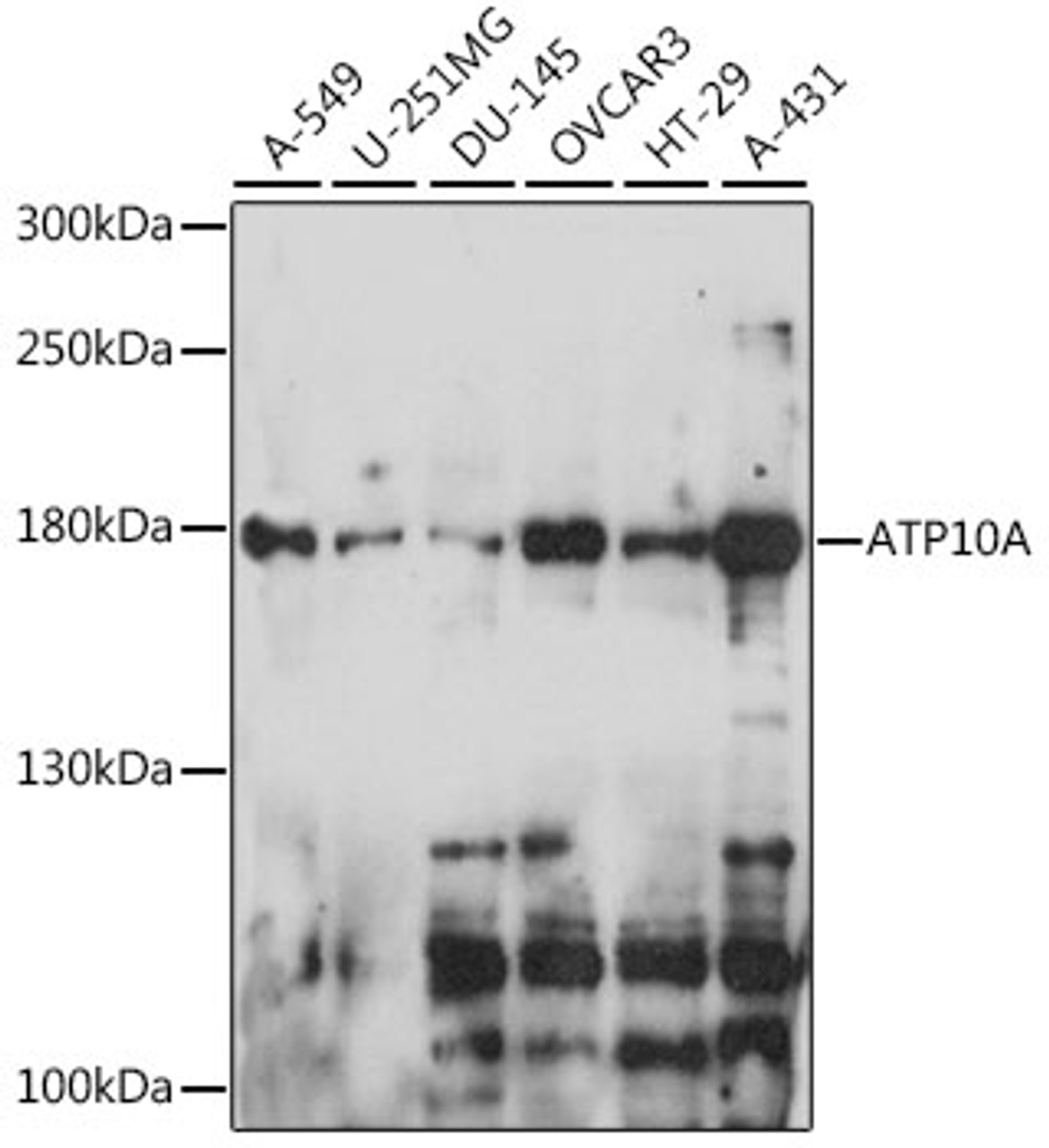 Western blot analysis of extracts of various cell lines, using ATP10A antibody (16-291) at 1:1000 dilution.<br/>Secondary antibody: HRP Goat Anti-Rabbit IgG (H+L) at 1:10000 dilution.<br/>Lysates/proteins: 25ug per lane.<br/>Blocking buffer: 3% nonfat dry milk in TBST.<br/>Detection: ECL Basic Kit.<br/>Exposure time: 30s.