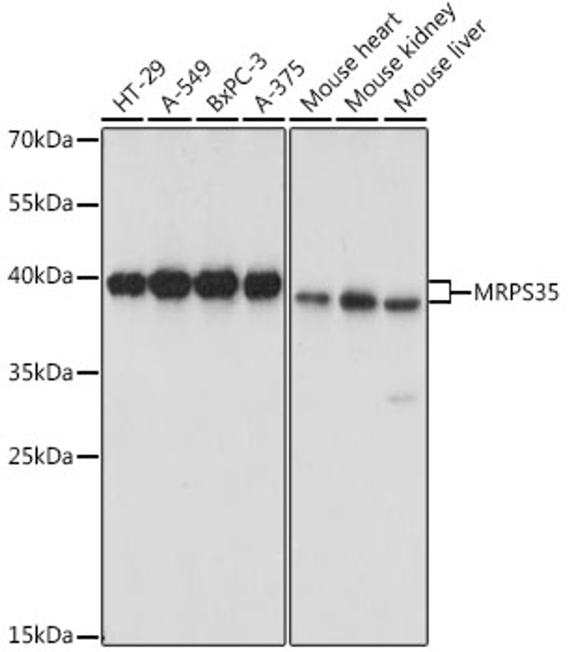 Western blot analysis of extracts of various cell lines, using MRPS35 antibody (16-293) at 1:1000 dilution.<br/>Secondary antibody: HRP Goat Anti-Rabbit IgG (H+L) at 1:10000 dilution.<br/>Lysates/proteins: 25ug per lane.<br/>Blocking buffer: 3% nonfat dry milk in TBST.<br/>Detection: ECL Basic Kit.<br/>Exposure time: 5s.