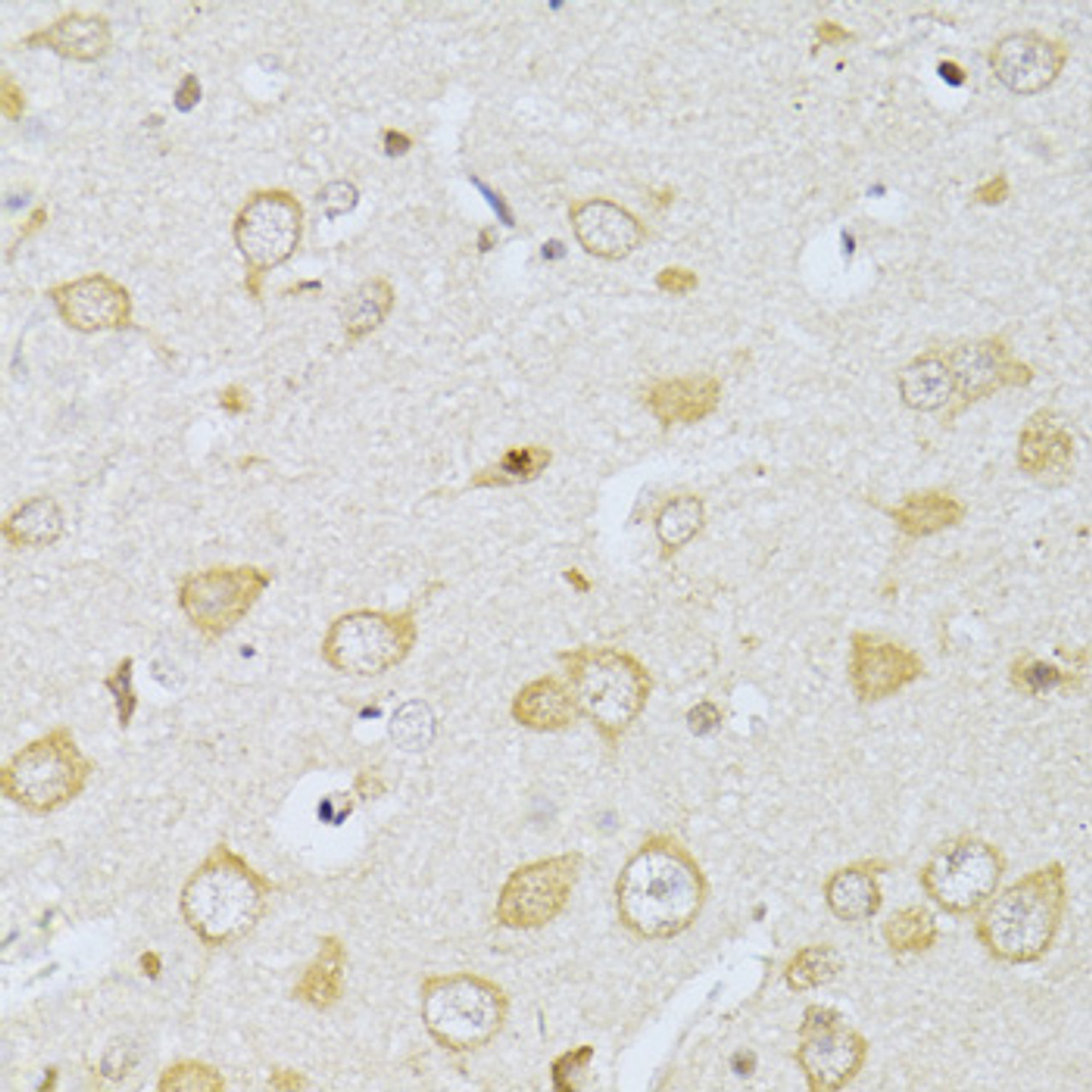 Immunohistochemistry of paraffin-embedded rat brain using CHRNA7 antibody (16-294) at dilution of 1:100 (40x lens) .