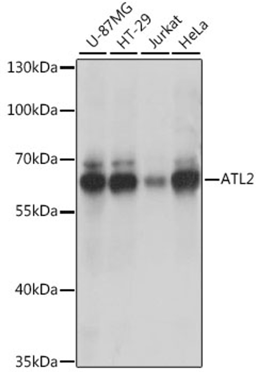 Western blot analysis of extracts of various cell lines, using ATL2 antibody (16-298) at 1:1000 dilution.<br/>Secondary antibody: HRP Goat Anti-Rabbit IgG (H+L) at 1:10000 dilution.<br/>Lysates/proteins: 25ug per lane.<br/>Blocking buffer: 3% nonfat dry milk in TBST.<br/>Detection: ECL Basic Kit.<br/>Exposure time: 10s.