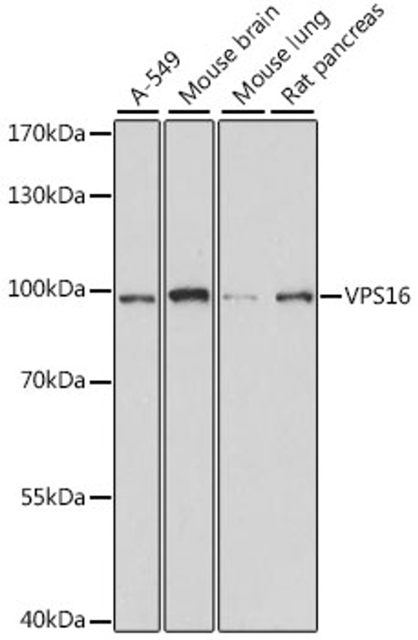 Western blot analysis of extracts of various cell lines, using VPS16 antibody (16-302) at 1:1000 dilution.<br/>Secondary antibody: HRP Goat Anti-Rabbit IgG (H+L) at 1:10000 dilution.<br/>Lysates/proteins: 25ug per lane.<br/>Blocking buffer: 3% nonfat dry milk in TBST.<br/>Detection: ECL Basic Kit.<br/>Exposure time: 1s.