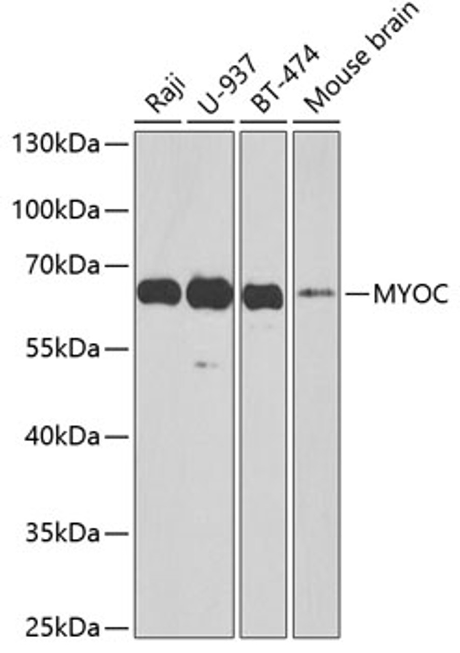 Western blot analysis of extracts of various cell lines, using MYOC antibody (16-304) at 1:1000 dilution.<br/>Secondary antibody: HRP Goat Anti-Rabbit IgG (H+L) at 1:10000 dilution.<br/>Lysates/proteins: 25ug per lane.<br/>Blocking buffer: 3% nonfat dry milk in TBST.<br/>Detection: ECL Basic Kit.<br/>Exposure time: 60s.