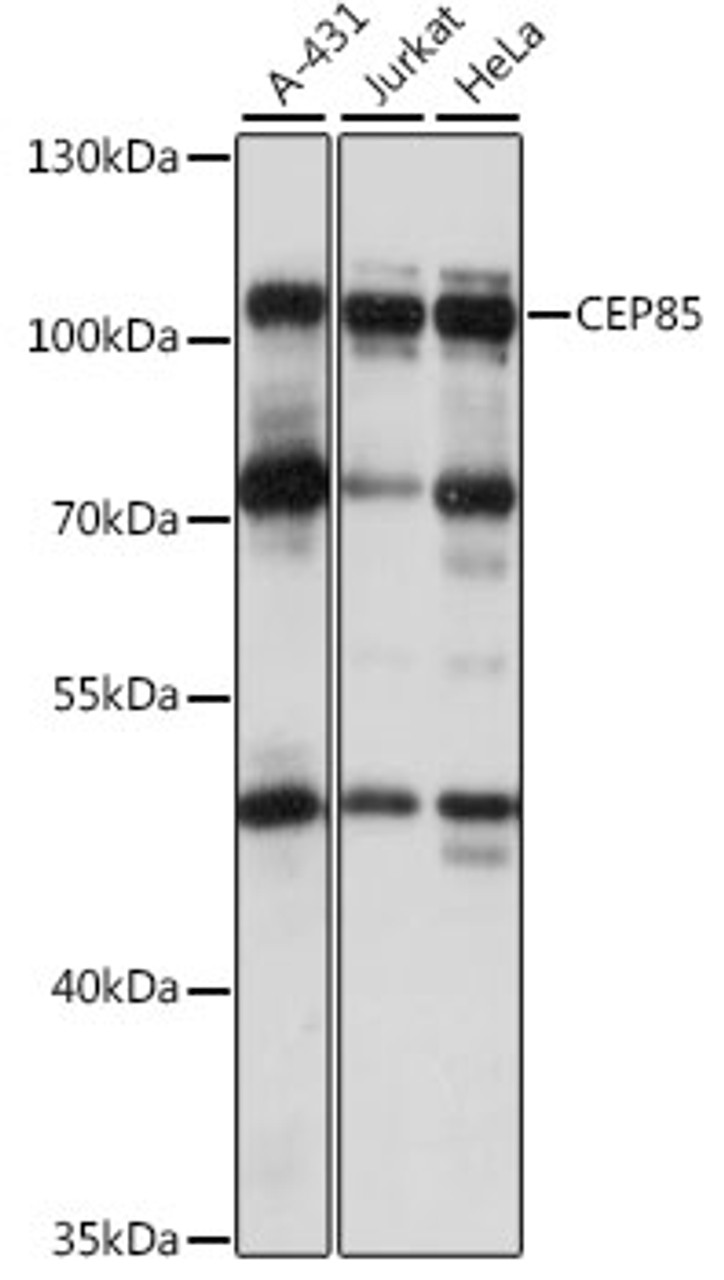 Western blot analysis of extracts of various cell lines, using CEP85 antibody (16-306) at 1:1000 dilution.<br/>Secondary antibody: HRP Goat Anti-Rabbit IgG (H+L) at 1:10000 dilution.<br/>Lysates/proteins: 25ug per lane.<br/>Blocking buffer: 3% nonfat dry milk in TBST.<br/>Detection: ECL Basic Kit.<br/>Exposure time: 10s.