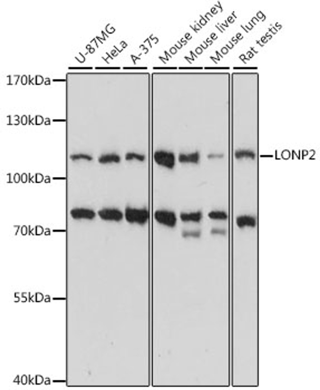 Western blot analysis of extracts of various cell lines, using LONP2 antibody (16-316) at 1:1000 dilution.<br/>Secondary antibody: HRP Goat Anti-Rabbit IgG (H+L) at 1:10000 dilution.<br/>Lysates/proteins: 25ug per lane.<br/>Blocking buffer: 3% nonfat dry milk in TBST.<br/>Detection: ECL Basic Kit.<br/>Exposure time: 5s.