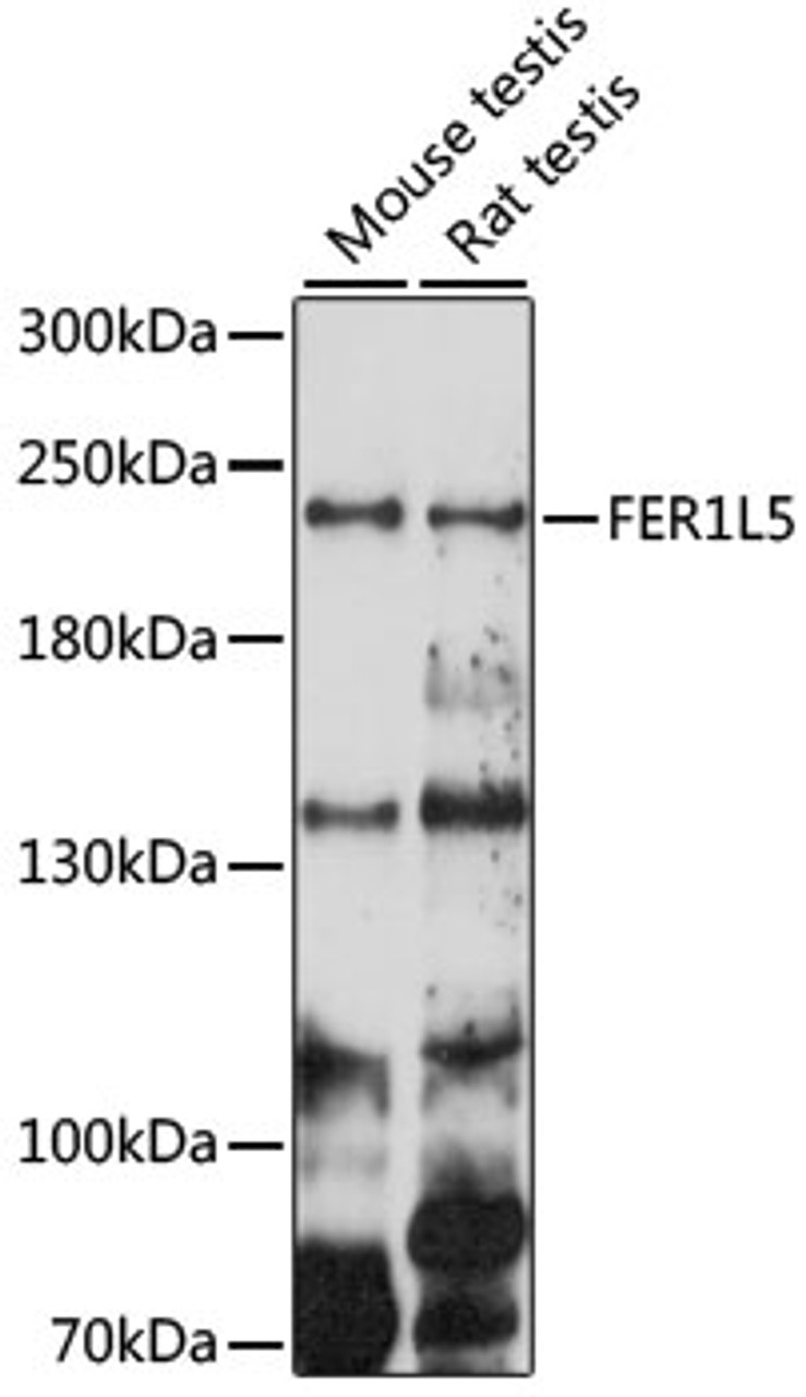 Western blot analysis of extracts of various cell lines, using FER1L5 antibody (16-324) at 1000 dilution.<br/>Secondary antibody: HRP Goat Anti-Rabbit IgG (H+L) at 1:10000 dilution.<br/>Lysates/proteins: 25ug per lane.<br/>Blocking buffer: 3% nonfat dry milk in TBST.<br/>Detection: ECL Basic Kit.<br/>Exposure time: 150s.